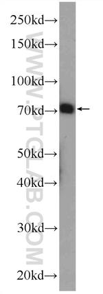 CUX1/Protein CASP Antibody in Western Blot (WB)