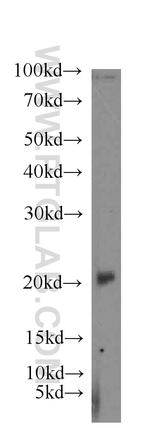 EID1 Antibody in Western Blot (WB)