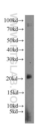 EID1 Antibody in Western Blot (WB)