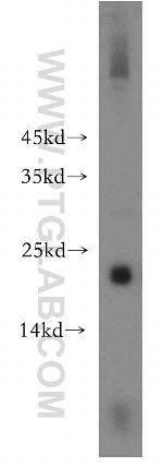 EID1 Antibody in Western Blot (WB)