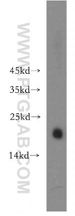 EID1 Antibody in Western Blot (WB)