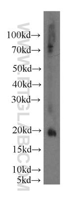 EID1 Antibody in Western Blot (WB)