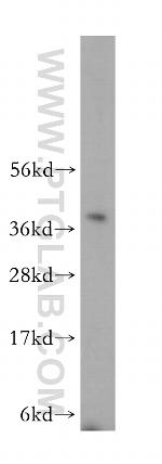 RPP40 Antibody in Western Blot (WB)