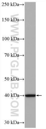 RPP40 Antibody in Western Blot (WB)