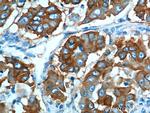 ASGR1 Antibody in Immunohistochemistry (Paraffin) (IHC (P))