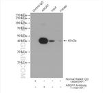 ASGR1 Antibody in Immunoprecipitation (IP)