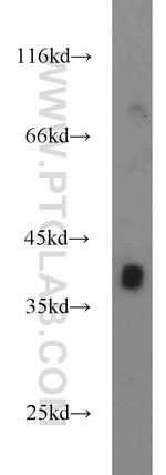 ASGR1 Antibody in Western Blot (WB)