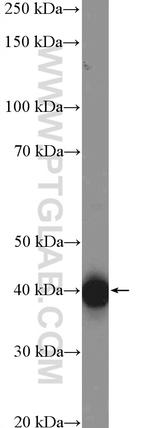 ASGR1 Antibody in Western Blot (WB)