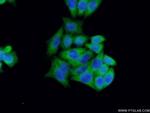 BCL7B Antibody in Immunocytochemistry (ICC/IF)