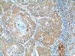 BCL7B Antibody in Immunohistochemistry (Paraffin) (IHC (P))