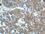 BCL7B Antibody in Immunohistochemistry (Paraffin) (IHC (P))