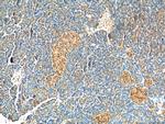 BCL7B Antibody in Immunohistochemistry (Paraffin) (IHC (P))