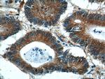 BCL7B Antibody in Immunohistochemistry (Paraffin) (IHC (P))