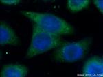 SPRR3 Antibody in Immunocytochemistry (ICC/IF)