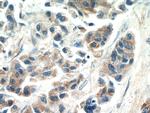 SPRR3 Antibody in Immunohistochemistry (Paraffin) (IHC (P))