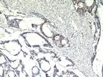 SPRR3 Antibody in Immunohistochemistry (Paraffin) (IHC (P))