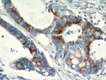 SPRR3 Antibody in Immunohistochemistry (Paraffin) (IHC (P))