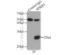 SPRR3 Antibody in Immunoprecipitation (IP)