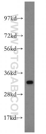 SPRR3 Antibody in Western Blot (WB)