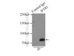 IFT81 Antibody in Immunoprecipitation (IP)