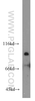 IFT81 Antibody in Western Blot (WB)