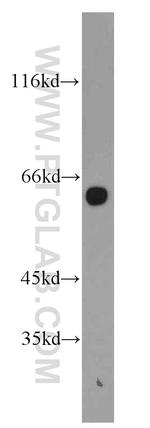 HBP1 Antibody in Western Blot (WB)