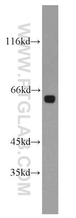 HBP1 Antibody in Western Blot (WB)