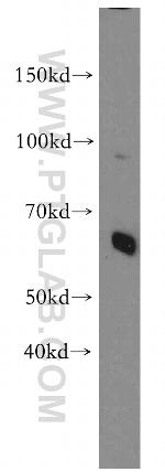 HBP1 Antibody in Western Blot (WB)
