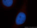 PSMB1 Antibody in Immunocytochemistry (ICC/IF)