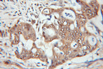 PSMB1 Antibody in Immunohistochemistry (Paraffin) (IHC (P))