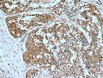 PSMB1 Antibody in Immunohistochemistry (Paraffin) (IHC (P))