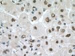 PSMB1 Antibody in Immunohistochemistry (Paraffin) (IHC (P))