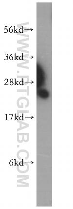 PSMB1 Antibody in Western Blot (WB)