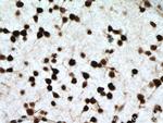 NFIA Antibody in Immunohistochemistry (Paraffin) (IHC (P))