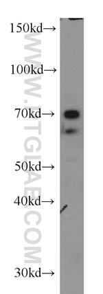 NFIA Antibody in Western Blot (WB)