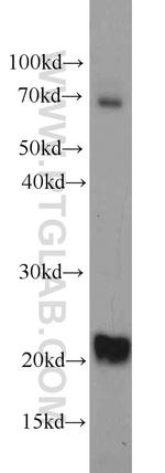 TWIST2 Antibody in Western Blot (WB)