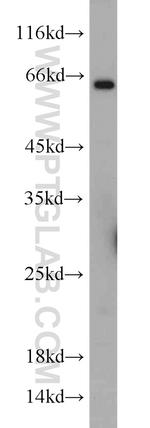 TWIST2 Antibody in Western Blot (WB)