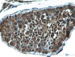 FKBP3 Antibody in Immunohistochemistry (Paraffin) (IHC (P))