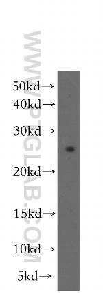 FKBP3 Antibody in Western Blot (WB)