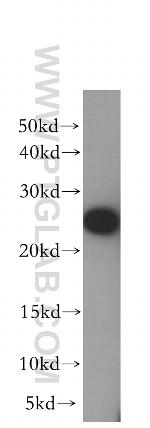 FKBP3 Antibody in Western Blot (WB)