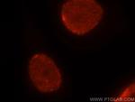 HNRNPC Antibody in Immunocytochemistry (ICC/IF)