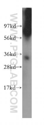 HNRNPC Antibody in Western Blot (WB)