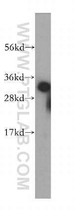 HNRNPC Antibody in Western Blot (WB)