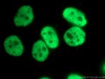 HNRNPC Antibody in Immunocytochemistry (ICC/IF)