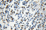 HNRNPC Antibody in Immunohistochemistry (Paraffin) (IHC (P))