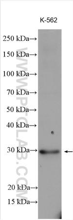 ENOPH1 Antibody in Western Blot (WB)