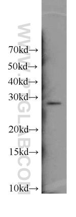 ENOPH1 Antibody in Western Blot (WB)