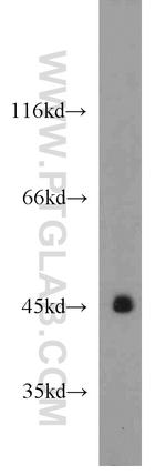 PANK1 Antibody in Western Blot (WB)