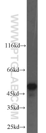 NAMPT/PBEF Antibody in Western Blot (WB)