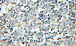 PTPN22 Antibody in Immunohistochemistry (Paraffin) (IHC (P))